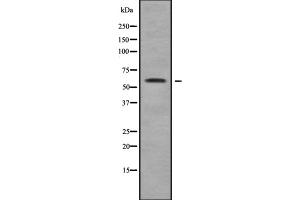 Western blot analysis of MAGE2 using COLO205 whole cell lysates (MAGEE2 抗体  (Internal Region))