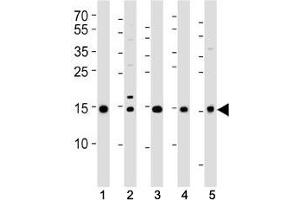 Western blot analysis of lysate from (1) 293T, (2) HeLa, (3) HL-60, (4) Jurkat cell lines and (5) rat liver tissue using SUMO2/3 antibody at 1:1000. (SUMO2/3 抗体  (AA 49-81))
