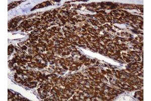 Image no. 7 for anti-B and T Lymphocyte Associated (BTLA) antibody (ABIN1496983)