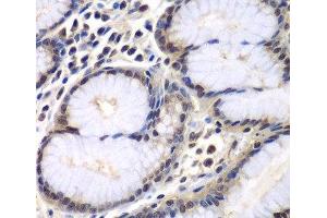 Immunohistochemistry (Paraffin-embedded Sections) (IHC (p)) image for anti-Proteasome (Prosome, Macropain) Subunit, beta Type 2 (PSMB2) antibody (ABIN7257244)