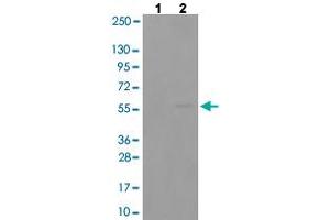 Western blot analysis of Lane 1: antigen-specific peptide treated COLO205 cells, Lane 2: COLO205 cells with SYT1 (phospho T202) polyclonal antibody  at 1:500-1:1000 dilution. (SYT1 抗体  (pThr202))
