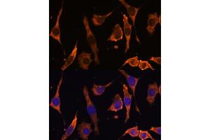 Immunofluorescence (IF) image for anti-Ribosomal Protein L36a-Like (RPL36AL) (AA 1-106) antibody (ABIN7270007)