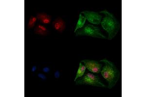 ABIN7094742 and ABIN7098793 staining  cells by IF/ICC. (SUV420H2/KMT5C 抗体  (Internal Region))