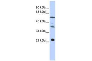 Image no. 1 for anti-Centromere Protein M (CENPM) (C-Term) antibody (ABIN6740964) (CENPM 抗体  (C-Term))