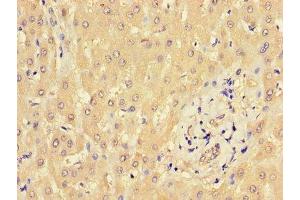Immunohistochemistry of paraffin-embedded human liver tissue using ABIN7165997 at dilution of 1:100 (BBS9 抗体  (AA 8-185))