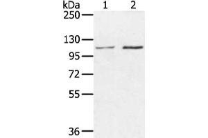 Gel: 6 % SDS-PAGE, Lysate: 40 μg, Lane 1-2: Hepg2 and hela cell, Primary antibody: ABIN7130215(MED16 Antibody) at dilution 1/400 dilution, Secondary antibody: Goat anti rabbit IgG at 1/8000 dilution, Exposure time: 20 seconds (MED16 抗体)