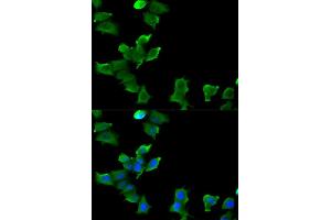 Immunofluorescence (IF) image for anti-Glutamate-Ammonia Ligase (GLUL) antibody (ABIN1876625) (GLUL 抗体)