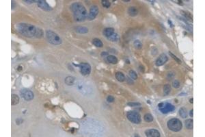 Immunohistochemistry (IHC) image for anti-Glyceraldehyde-3-Phosphate Dehydrogenase (GAPDH) (AA 2-148) antibody (ABIN7426391)