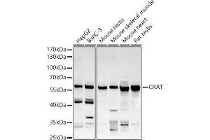 Western blot analysis of extracts of various cell lines, using CRAT antibody (ABIN6131297, ABIN6139003, ABIN6139004 and ABIN6221982) at 1:500 dilution. (CRAT 抗体  (AA 357-626))