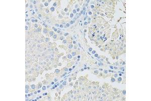 Immunohistochemistry of paraffin-embedded mouse testis using SLC2A9 antibody (ABIN6291466) at dilution of 1:100 (40x lens). (SLC2A9 抗体)