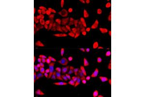 Immunofluorescence (IF) image for anti-Ribosomal Protein L8 (RPL8) (AA 1-257) antibody (ABIN6147155)
