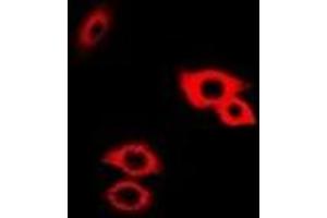 Immunofluorescent analysis of Alpha-galactosidase A staining in Hela cells. (GLA 抗体)