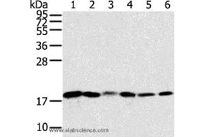 Western blot analysis of Human colon sigmoideum cancer and colon cancer tissue, mouse lung and human normal colon tissue, lovo and hela cell, using SNX3 Polyclonal Antibody at dilution of 1:250 (Sorting Nexin 3 抗体)