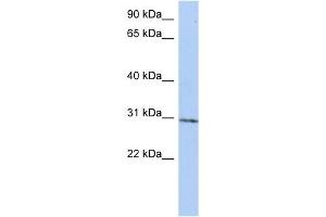 C14ORF172 antibody used at 1 ug/ml to detect target protein. (TRMT61A 抗体  (N-Term))