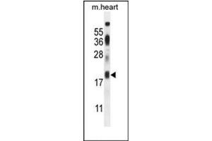 Western blot analysis of ISCA2 / HBLD1 Antibody (Center) in mouse heart tissue lysates (35ug/lane).