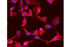 IF analysis of PCK1/PEPC using anti-PCK1/PEPC antibody (ABIN7599502).