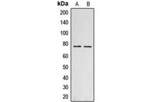 Western blot analysis of Collagen 18 alpha 1 expression in MCF7 (A), PC12 (B) whole cell lysates. (COL18A1 抗体  (C-Term))