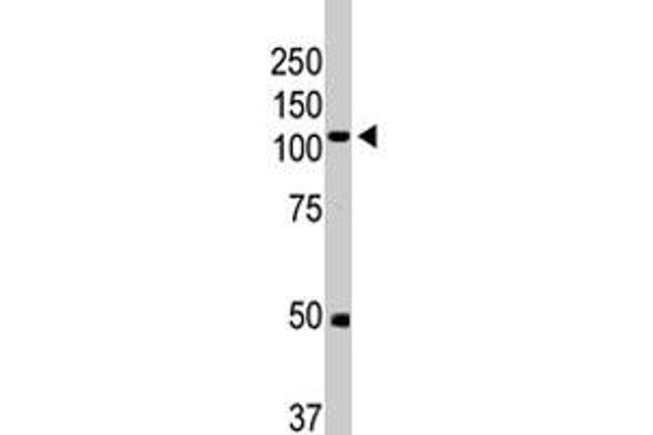 BMPR2 抗体  (AA 28-59)