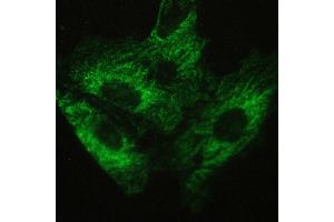 IHC analysis of ATX2 using anti-ATX2 antibody . (Ataxin 2 抗体  (C-Term))