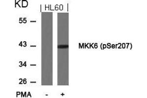 Western blot analysis of extracts from HL60 cells untreated or treated with PMA using MKK6(Phospho-Ser207) Antibody.