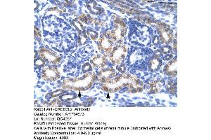 Human kidney (CREB3L2 抗体  (N-Term))