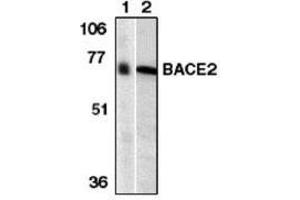 Image no. 1 for anti-beta-Site APP-Cleaving Enzyme 2 (BACE2) (AA 44-59) antibody (ABIN264996) (BACE2 抗体  (AA 44-59))