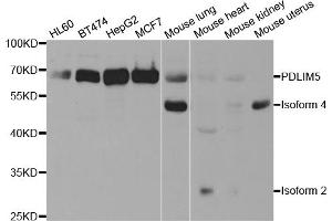 Western blot analysis of extracts of various cell lines, using PDLIM5 antibody (ABIN5973350) at 1/1000 dilution. (PDLIM5 抗体)