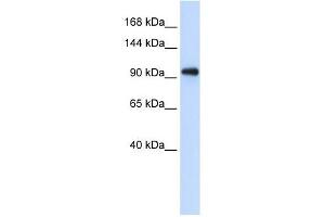 EXOSC10 antibody used at 1 ug/ml to detect target protein. (EXOSC10 抗体  (Middle Region))
