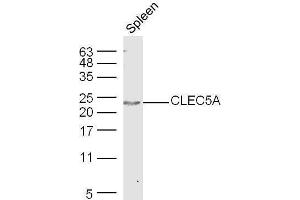 Mouse spleen lysates probed with Rabbit Anti-CLEC5A Polyclonal Antibody, Unconjugated  at 1:500 for 90 min at 37˚C. (CLEC5A 抗体  (AA 101-190))