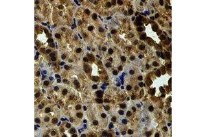 Immunohistochemical analysis of EYA3 staining in rat kidney formalin fixed paraffin embedded tissue section. (EYA3 抗体)
