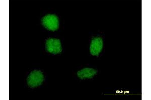 Immunofluorescence of monoclonal antibody to SOX21 on HeLa cell. (SOX21 抗体  (AA 224-265))