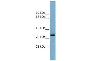 OTUD6B antibody used at 1 ug/ml to detect target protein. (OTUD6B 抗体  (Middle Region))