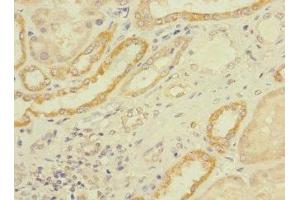 Immunohistochemistry of paraffin-embedded human kidney tissue using ABIN7158484 at dilution of 1:100 (LONRF1 抗体  (AA 538-773))
