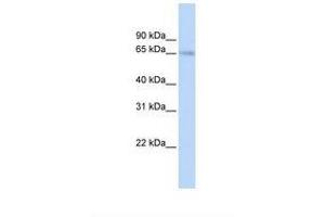 Image no. 1 for anti-Solute Carrier Family 22 Member 6 (SLC22A6) (C-Term) antibody (ABIN6749721) (SLC22A6 抗体  (C-Term))