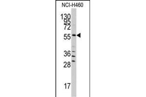 Western blot analysis of anti-SARS Antibody (C-term) (ABIN392296 and ABIN2841952) in NCI- cell line lysates (35 μg/lane). (Seryl-tRNA Synthetase (SARS) (AA 394-422), (C-Term) 抗体)
