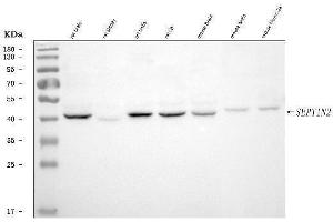 Western blot analysis of Septin 2/SEPTIN2 using anti-Septin 2/SEPTIN2 antibody (ABIN7599275). (Septin 2 抗体  (AA 1-326))