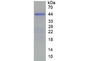 SDS-PAGE analysis of Human HIST2H2AC Protein. (HIST2H2AC 蛋白)