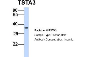 Host: Rabbit Target Name: TSTA3 Sample Type: Hela Antibody Dilution: 1. (TSTA3 抗体  (N-Term))