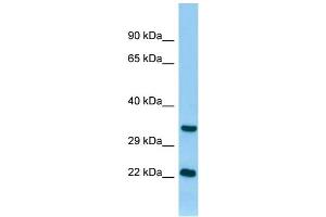 WB Suggested Anti-Tnni3 Antibody Titration: 1. (TNNI3 抗体  (N-Term))
