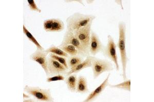 Immunohistochemistry (IHC) image for anti-Budding Uninhibited By Benzimidazoles 3 Homolog (Yeast) (BUB3) (AA 76-90), (Middle Region) antibody (ABIN3044239)