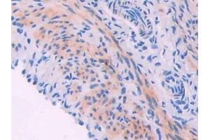 Immunohistochemistry (IHC) image for anti-Myosin Light Chain Kinase (MYLK) (AA 1684-1884) antibody (ABIN7439105)