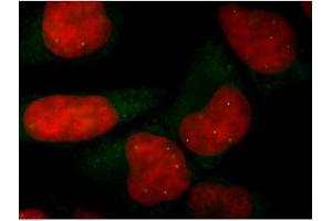 Image no. 2 for anti-Survival of Motor Neuron 1, Telomeric (SMN1) antibody (ABIN108566) (SMN1 抗体)
