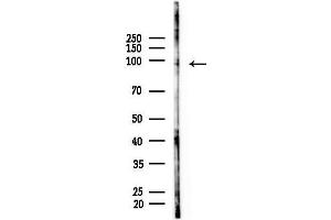 anti-Transmembrane Protein 63B (TMEM63B) antibody