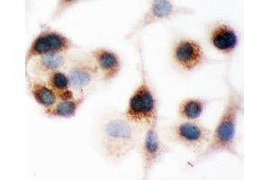 Anti-Bid Picoband antibody,  ICC: A549 Cell (BID 抗体  (AA 1-195))