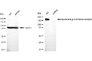 Western blotting analysis using epidermal growth factor receptor antibody (ABIN7798475).