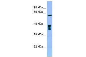 WB Suggested Anti-SLC22A5 Antibody Titration: 1. (SLC22A5 抗体  (C-Term))