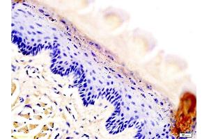 Formalin-fixed and rat tongue tissue labeled with Anti-AQP-3 Polyclonal Antibody, Unconjugated at 1:200 followed by conjugation to the secondary antibody and DAB staining (AQP3 抗体  (AA 201-292))