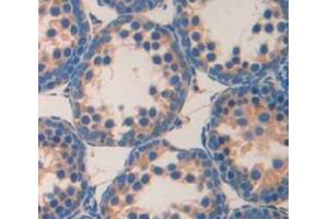 Used in DAB staining on fromalin fixed paraffin- embedded testis tissue (MAST2 抗体  (AA 512-785))