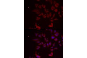 Immunofluorescence analysis of MCF-7 cells using RPL11 antibody. (RPL11 抗体)
