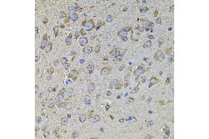 Immunohistochemistry of paraffin-embedded mouse brain using CPOX antibody (ABIN5971997) at dilution of 1/100 (40x lens). (CPOX 抗体)
